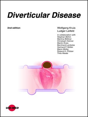 cover image of Diverticular Disease